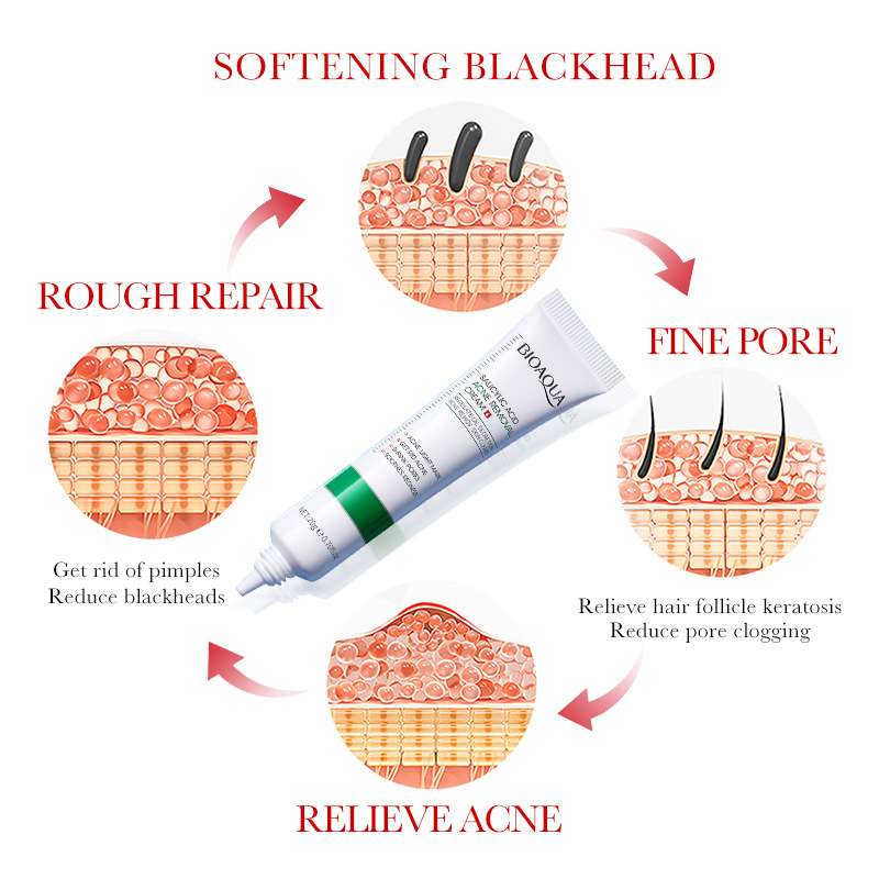 1/2/3pcs BIOAQUA Salicylic Aci - Azelaic Acid Cream review and price