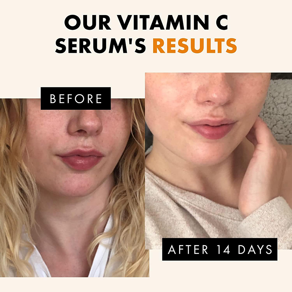 120ml 99% Vitamin C Serum Oil  - Skincare Garnier review and price