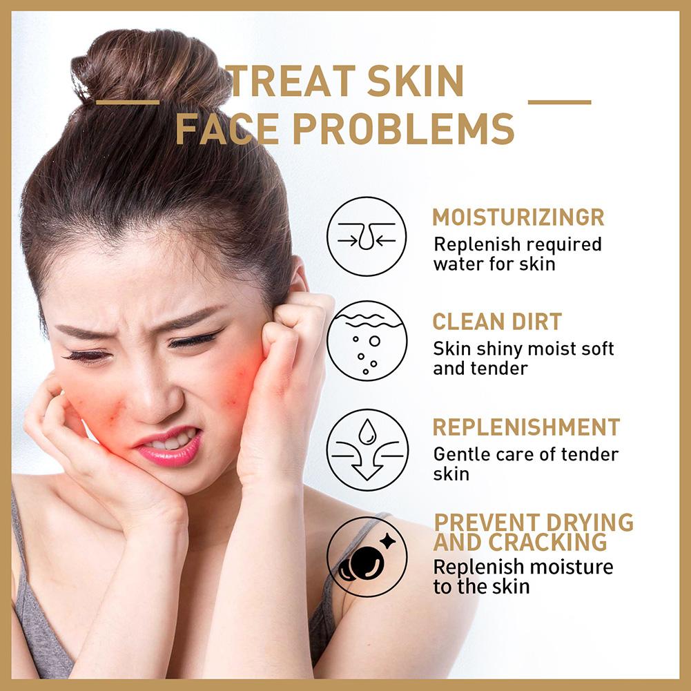 Rice Face Toner Moisturizing H - Skincare Garnier review and price