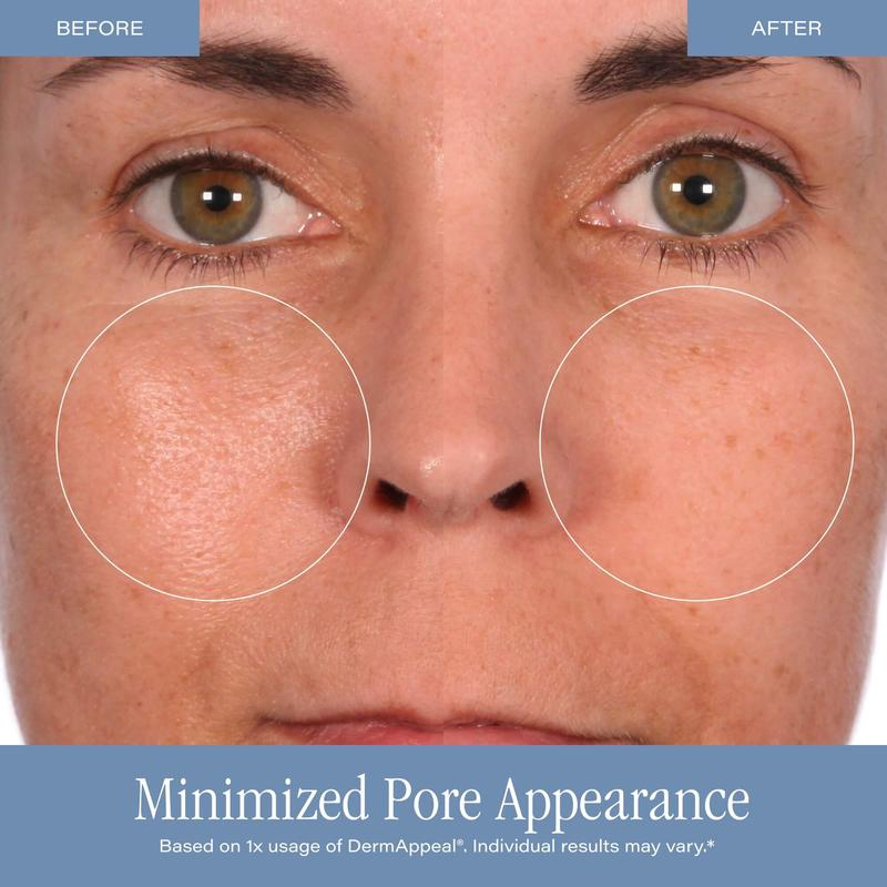 Cosmetics DermAppeal Microderm - Skincare Exfoliating review and price