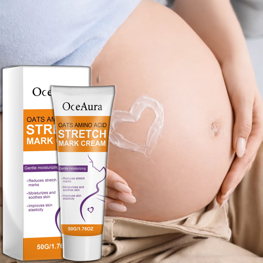 Stretch Marks Body Cream Light - Skincare Oat review and price